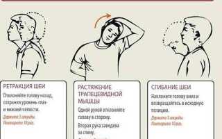 Гимнастика для остеохондроза шейного отдела