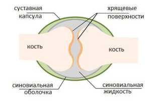 Первичный полиостеоартроз