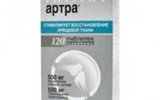 Артра инъекции
