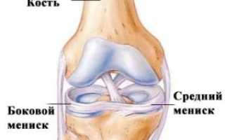 Бубновский мениск коленного сустава