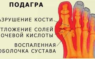 Томатный сок при подагре