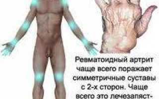 Ревматоидный артрит последствия