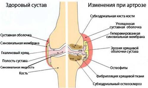 Причины недуга и методы его устранения