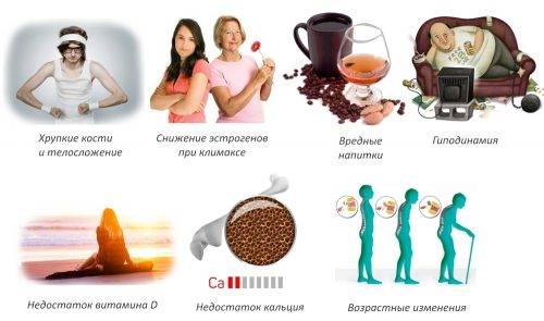Причины остеопороза