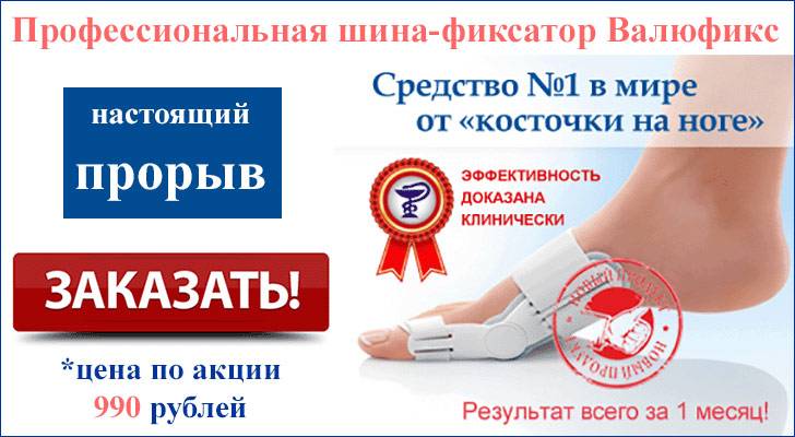 фиксатор валюфикс