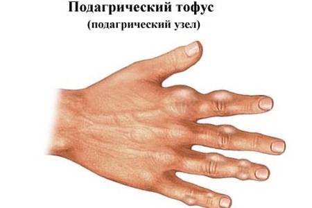 tofus