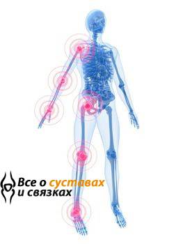 Ревматизм: симптомы