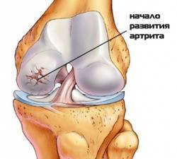 начальная стадия