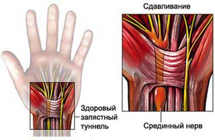 рука