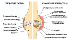 Строение коленного сустава